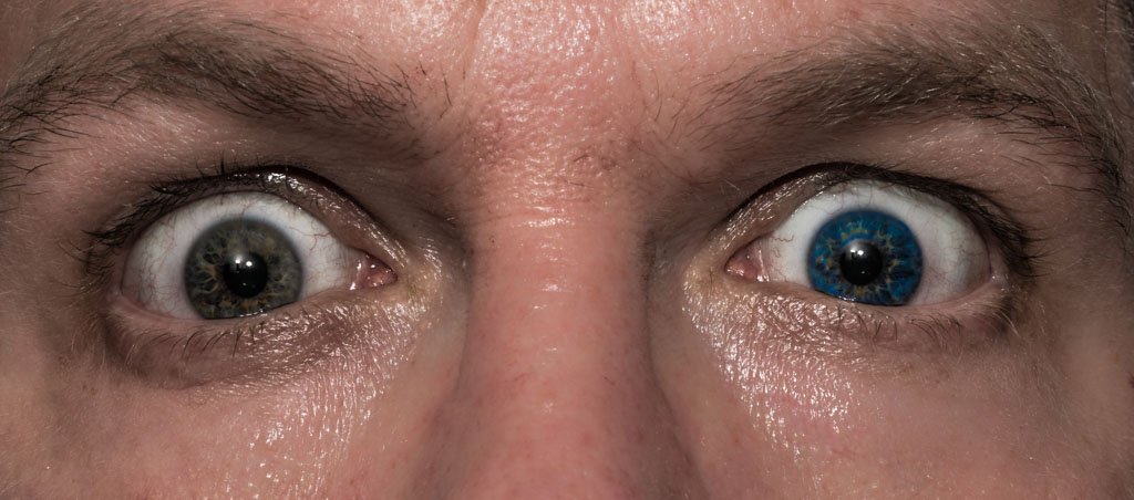 National Different Colored Eyes Day - Tag der Iris-Heterochromie in den USA. Kuriose Feiertage - 12. Juli © 2016 Sven Giese